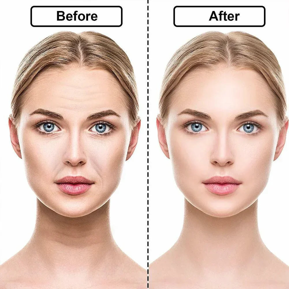 ✨Silicone Anti-Wrinkle Patches – Look 10 to 20 Years Younger Instantly! ✨