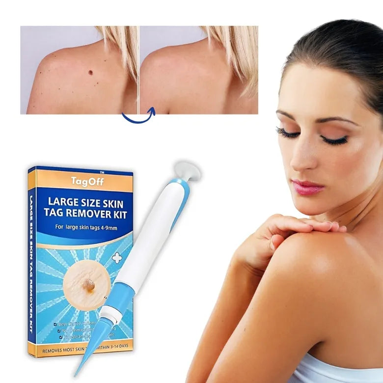 🚫 Say Goodbye to Embarrassing Skin Tags & Warts — Fast, Safe, & Painless!