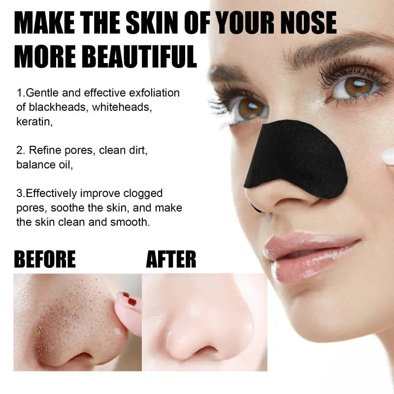 DeepClean Blackhead Remover Strips (20pcs)