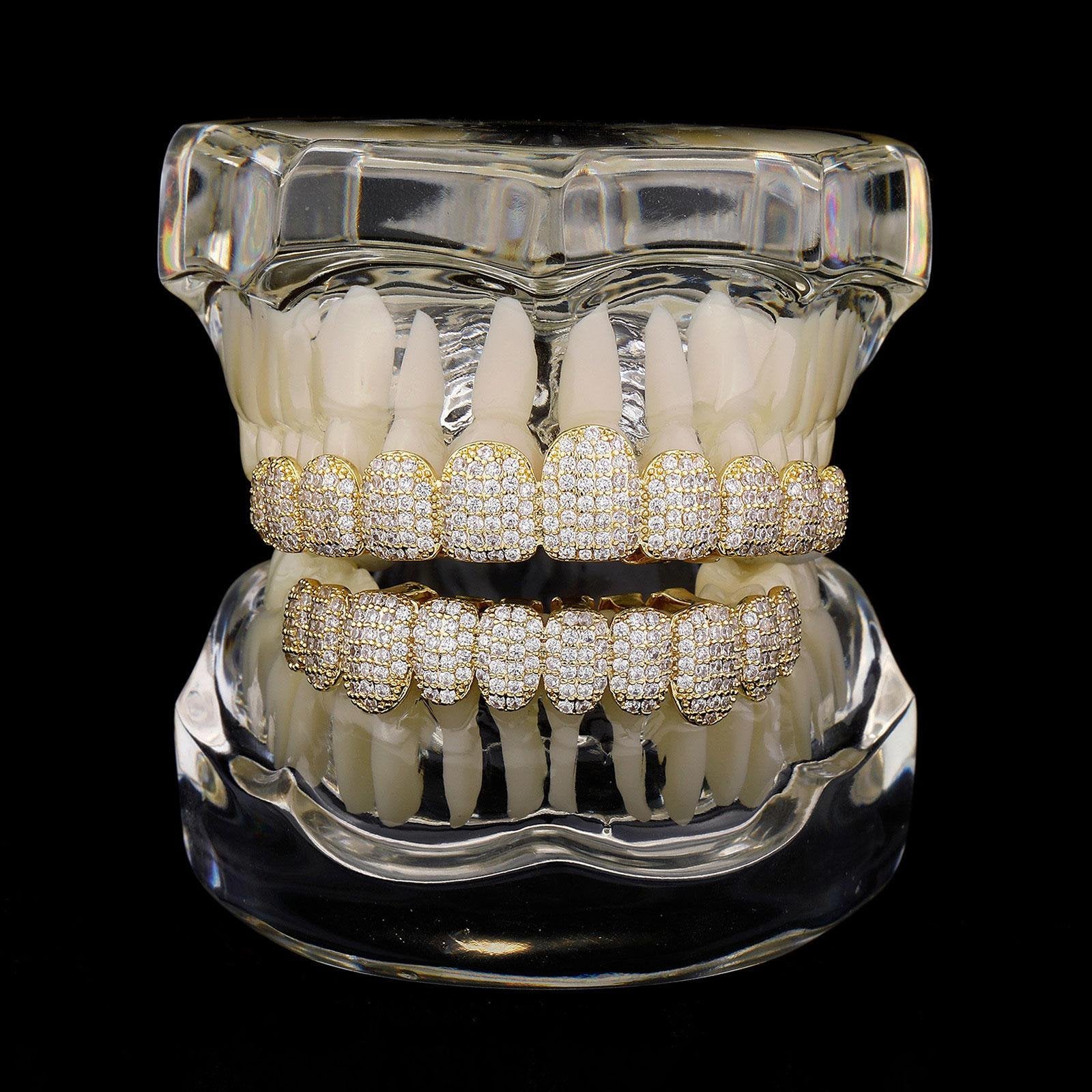 VitalStyle™ Diamond Iced Grills – Top & Bottom Set