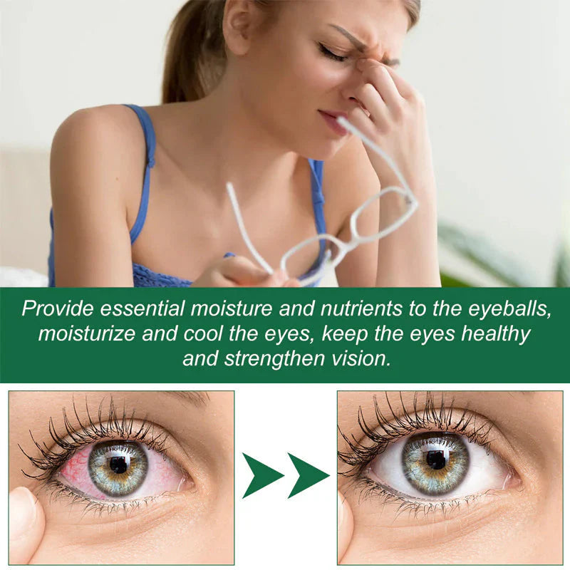 👁 THE ONLY EYE CARE SOLUTION YOU'LL EVER NEED! 👁