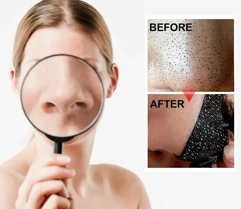 DeepClean Blackhead Remover Strips (20pcs)