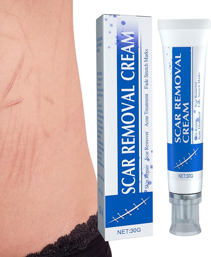 β¨ Scar Removal Cream β Advanced Repair for Flawless Skin! β¨