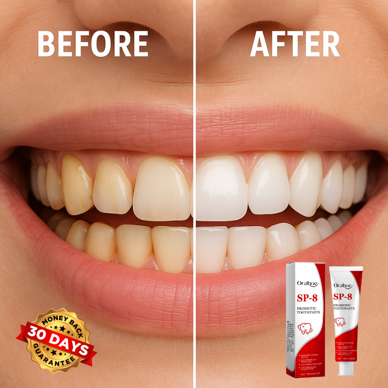 SmilePro™ SP-8 Probiotic Toothpaste