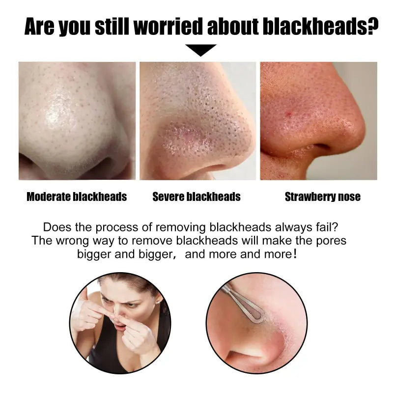 DeepClean Blackhead Remover Strips (20pcs)