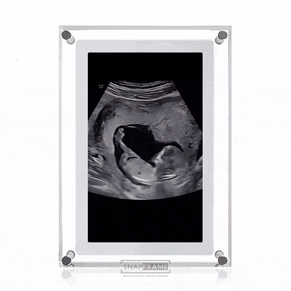 🎥SnapFrame™ Digital Picture Frame – Capture & Relive Precious Moments Instantly! 💖