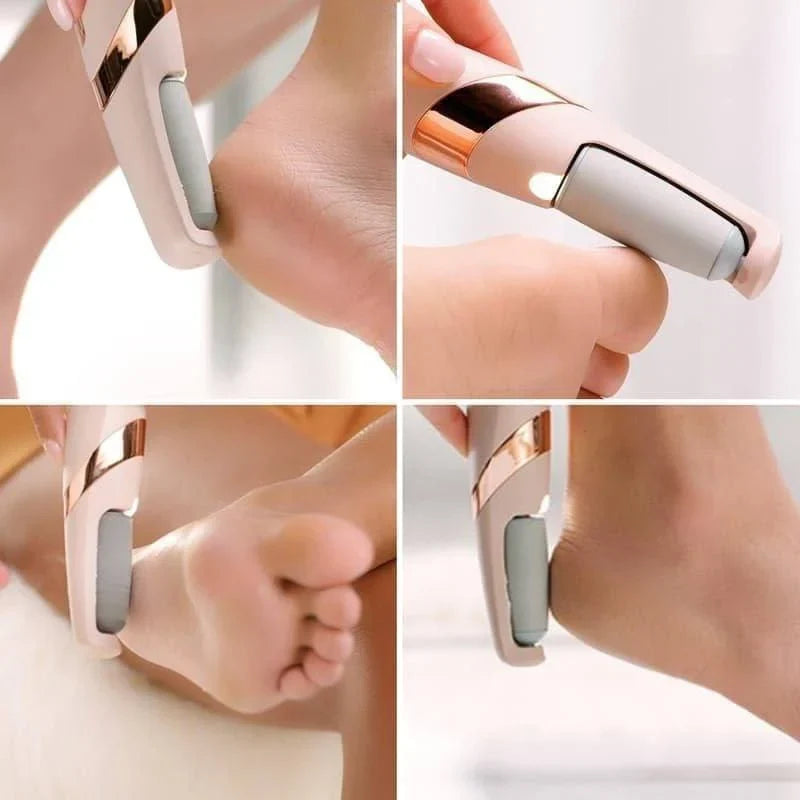🦶 Flawless Foot Callus Remover – Salon-Quality Pedicure at Home! 🦶