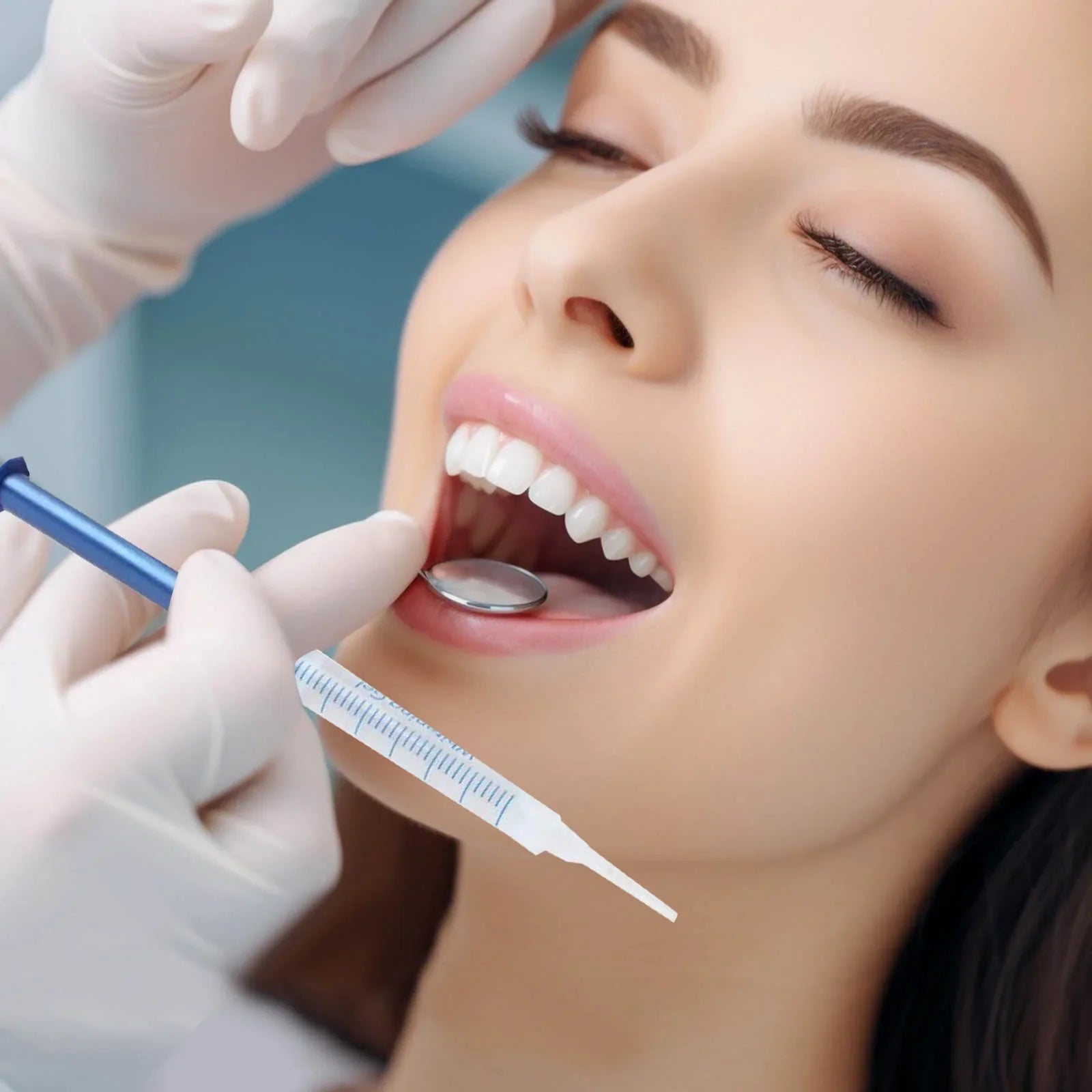 VitalSmyle™ Bright Teeth Whitening Kit – The #1 Choice for a Radiant Smile