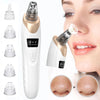 🌟 Electric Blackhead Remover – Instantly Clear Your Skin! 🌟