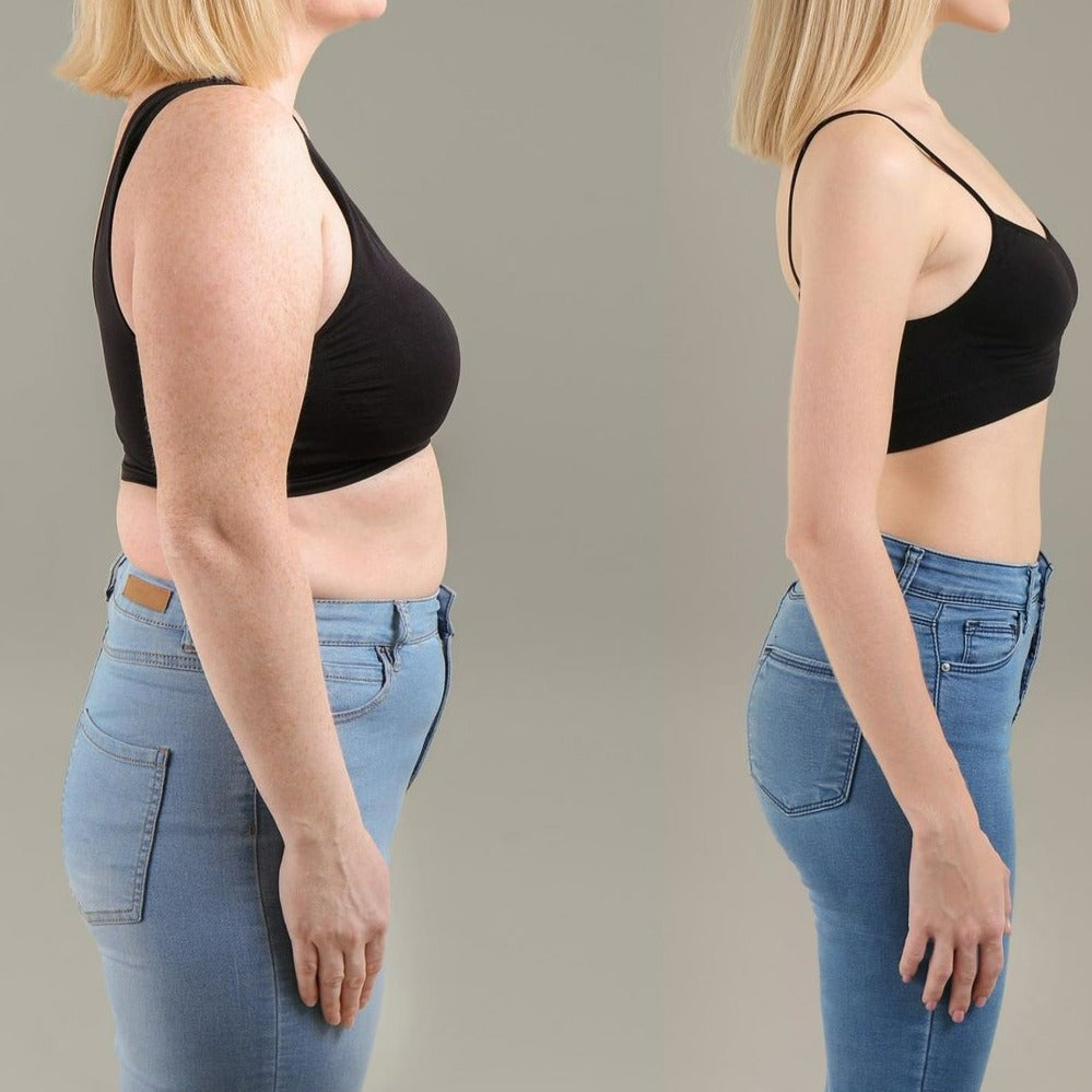 VItalSmyle CelAway™ | Say goodbye to fat and cellulite!