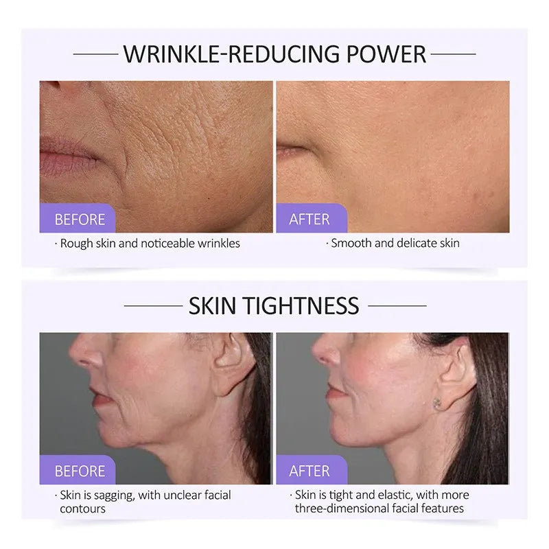 ✨ JoyPretty™ – Instant Lift Collagen Serum