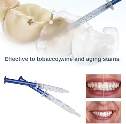VitalSmyle™ Bright Teeth Whitening Kit – The #1 Choice for a Radiant Smile