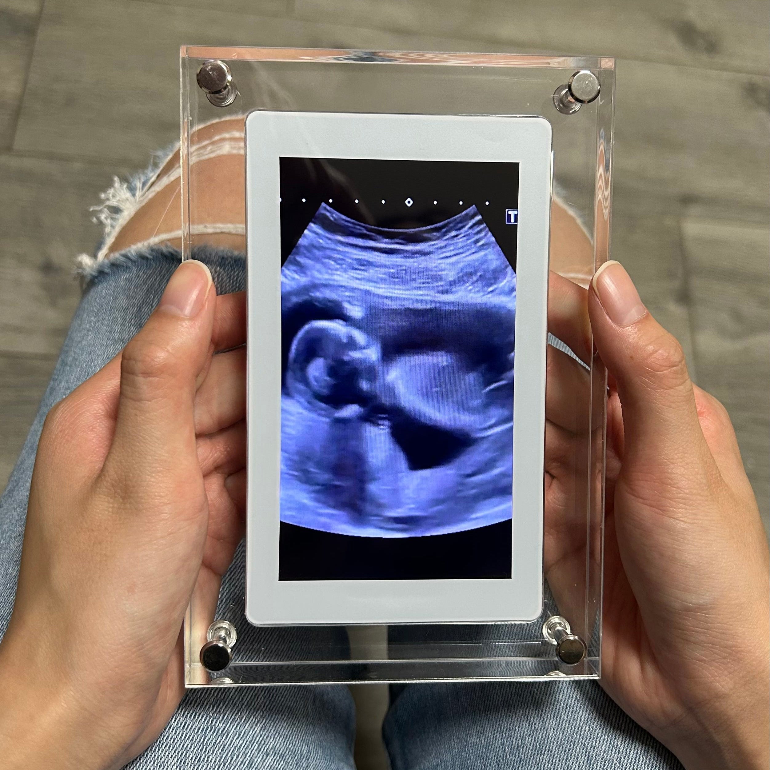🎥SnapFrame™ Digital Picture Frame – Capture & Relive Precious Moments Instantly! 💖