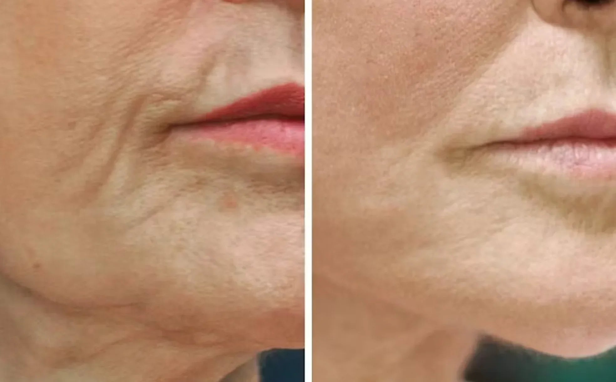 ✨ Face Night Mask – Collagen Wrapping Mask for Firmer, Hydrated, and Youthful Skin ✨