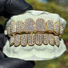 VitalStyle™ Diamond Iced Grills – Top & Bottom Set