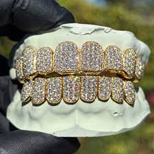 VitalStyle™ Diamond Iced Grills – Top & Bottom Set