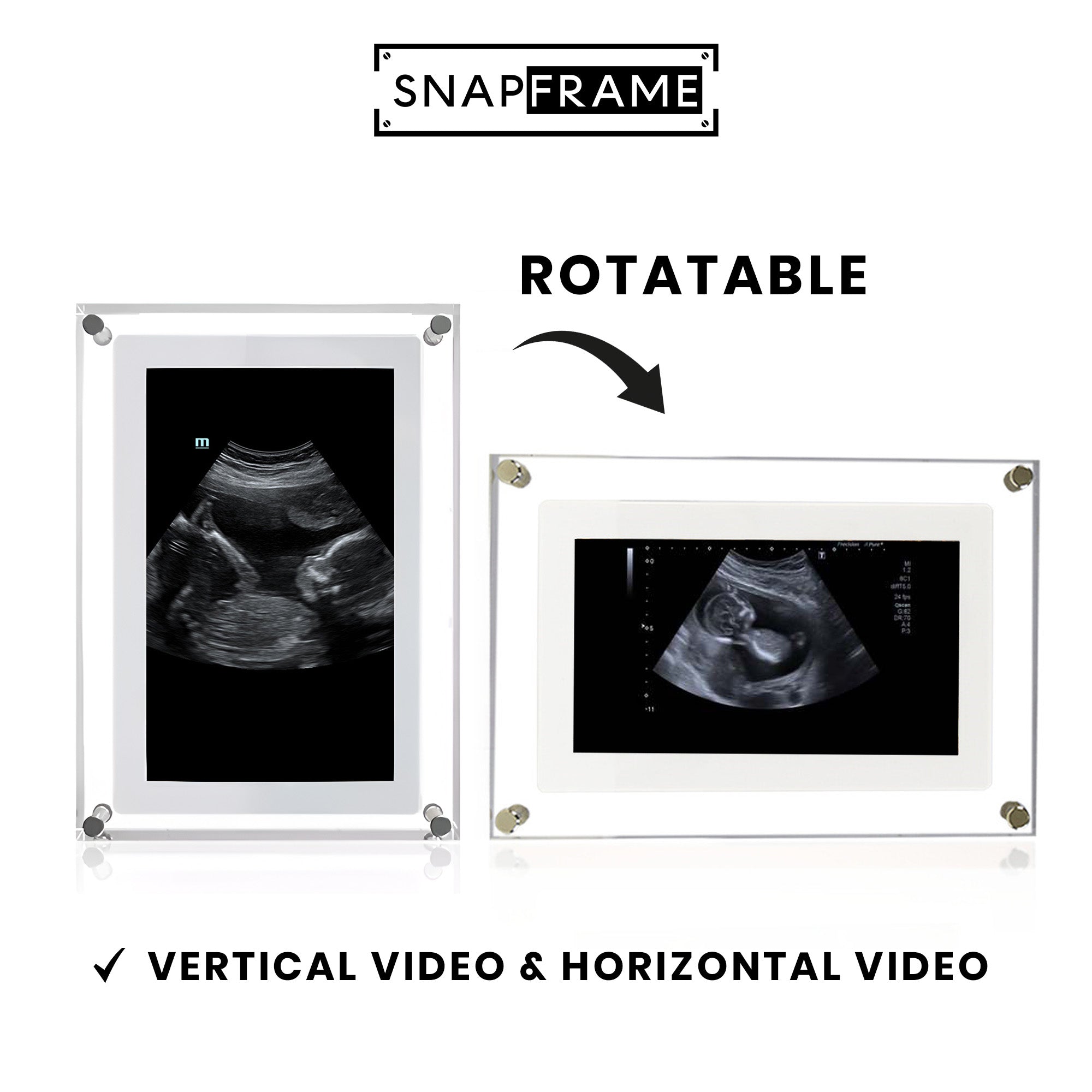 🎥SnapFrame™ Digital Picture Frame – Capture & Relive Precious Moments Instantly! 💖